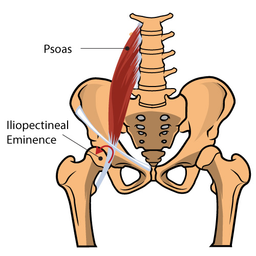 Snapping Hip The Iliopsoas Tendon Illinois Chiropractic Society 9048