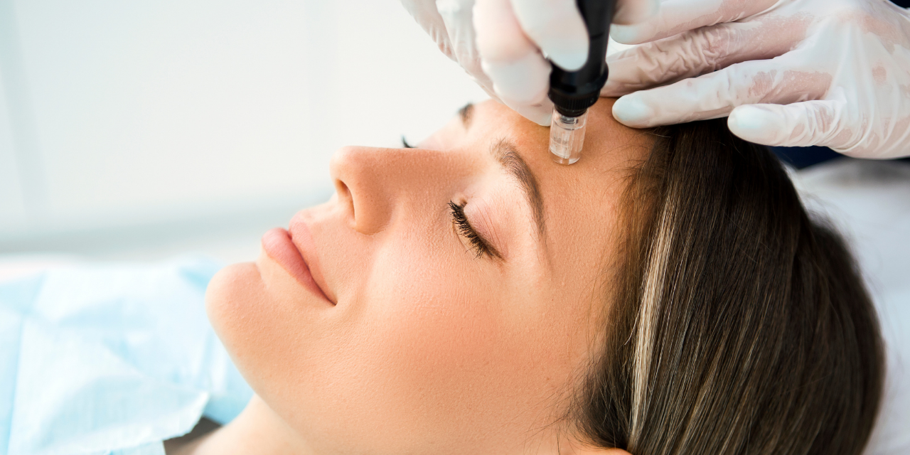 MAY CHIROPRACTIC PHYSICIANS PERFORM MICRONEEDLING?