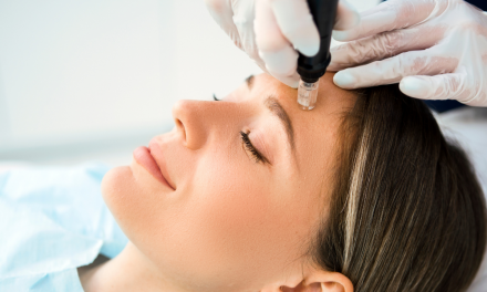 MAY CHIROPRACTIC PHYSICIANS PERFORM MICRONEEDLING?