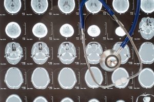 Radiographic images of brain