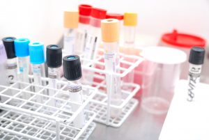Test tubes in rack