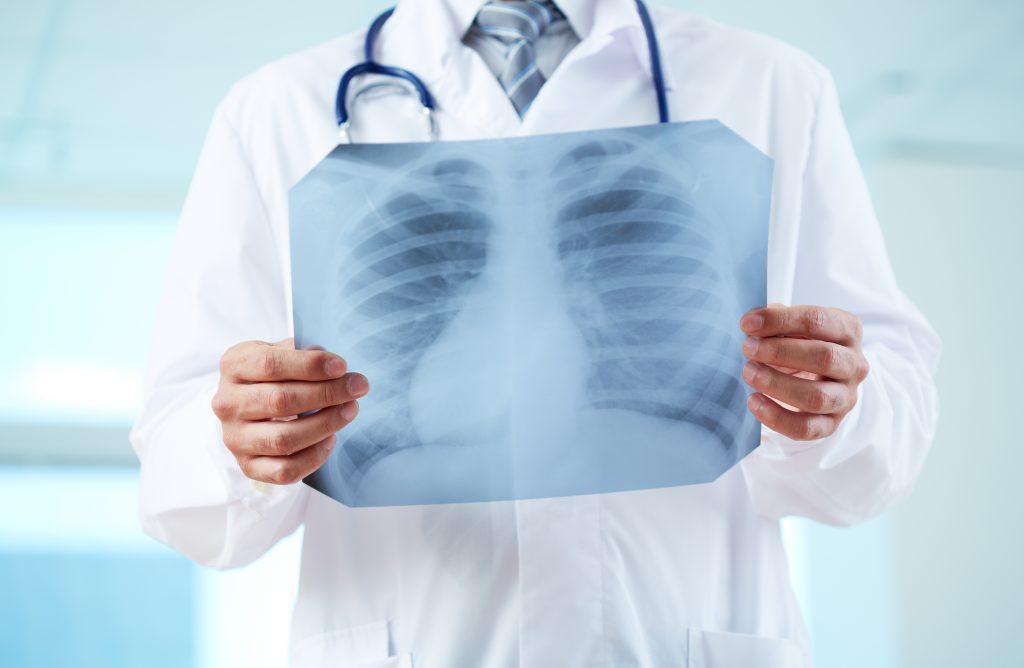 Doctor reviewing radiology scan