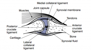Diagram of degenerative joint disease