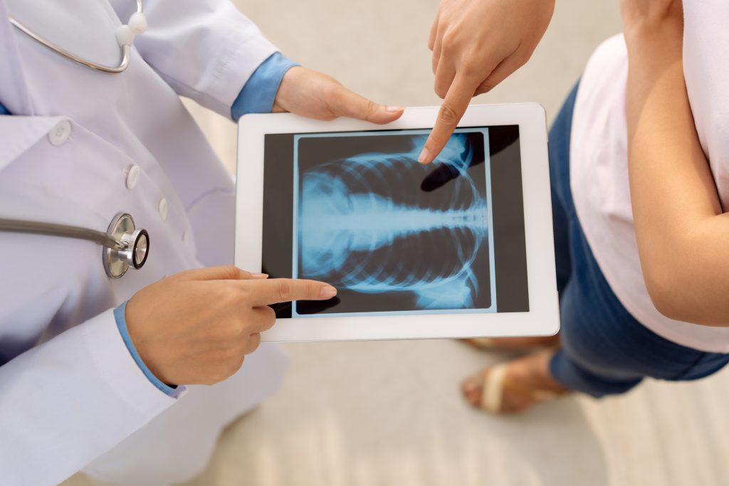 Doctor reviewing radiology scan