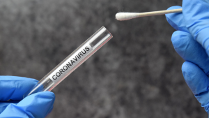 COVID-19 test