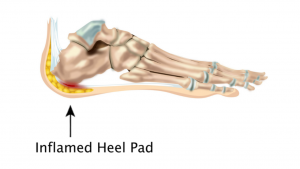 Diagram of foot