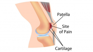 Diagram of knee