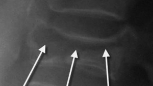 X-ray image