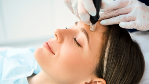 Patient receiving microneedling