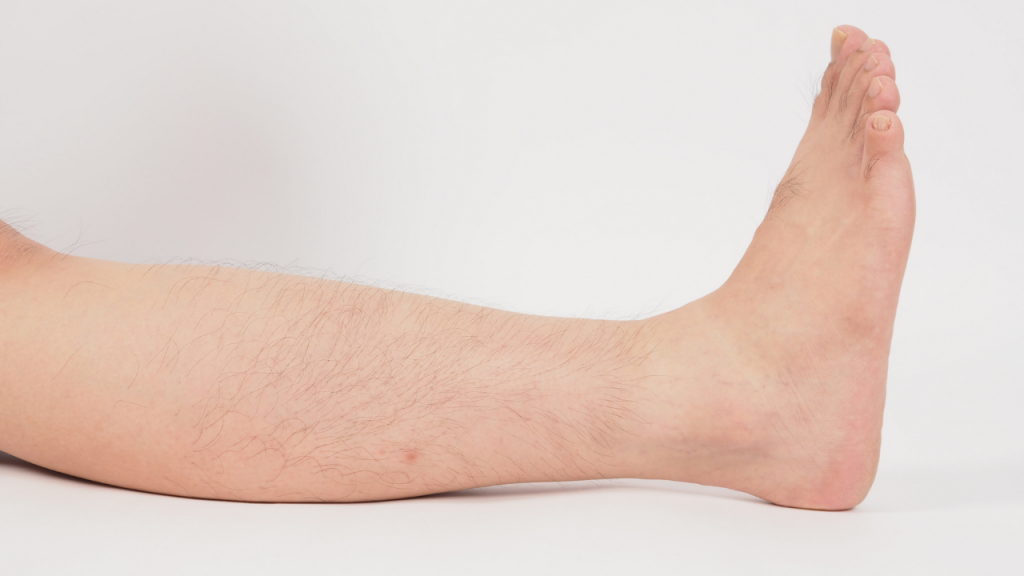 Image of a person's leg