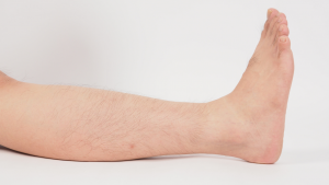 Image of a person's leg