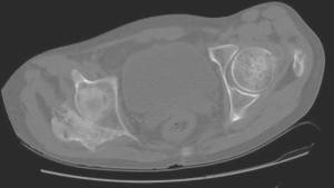 Radiographic image