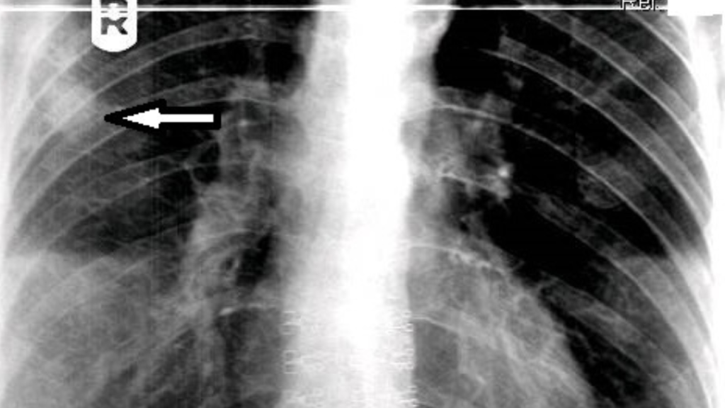 Radiographic image