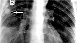 Radiographic image