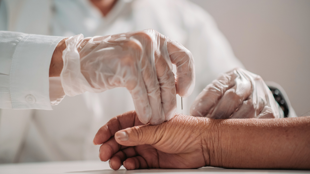 Person receiving acupuncture