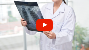 Doctor reviewing radiographic image