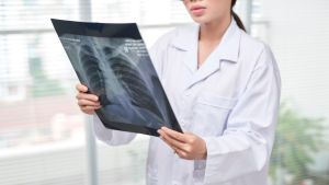 Doctor reviewing X-ray