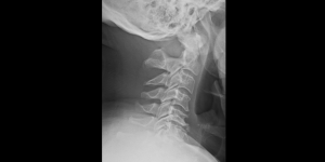 Radiographic image