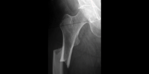 radiographic image
