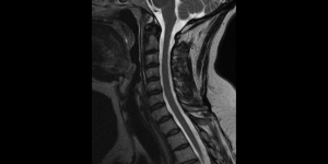 Radiographic image