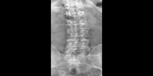 Radiographic image