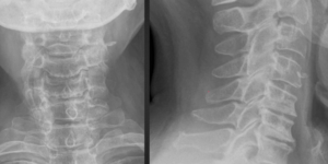 Radiographic image
